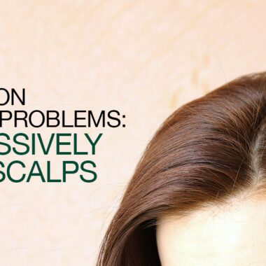 How To Maintain A Healthy Scalp In Hot Summer Weather