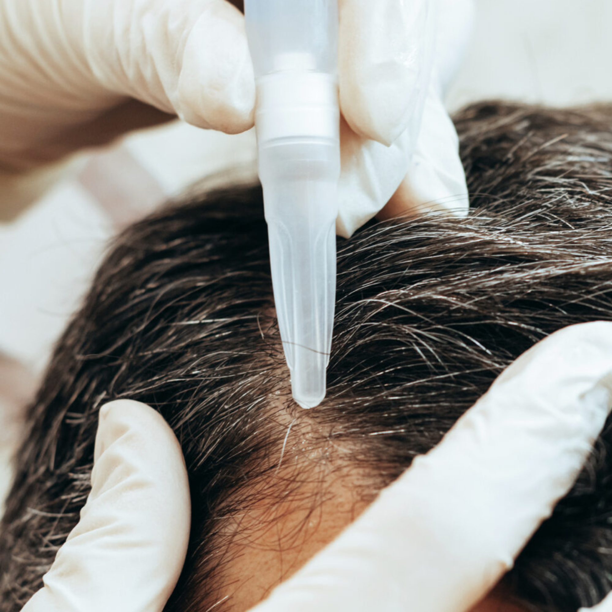 DRGL-DrHair Hair loss Transformation Package-01