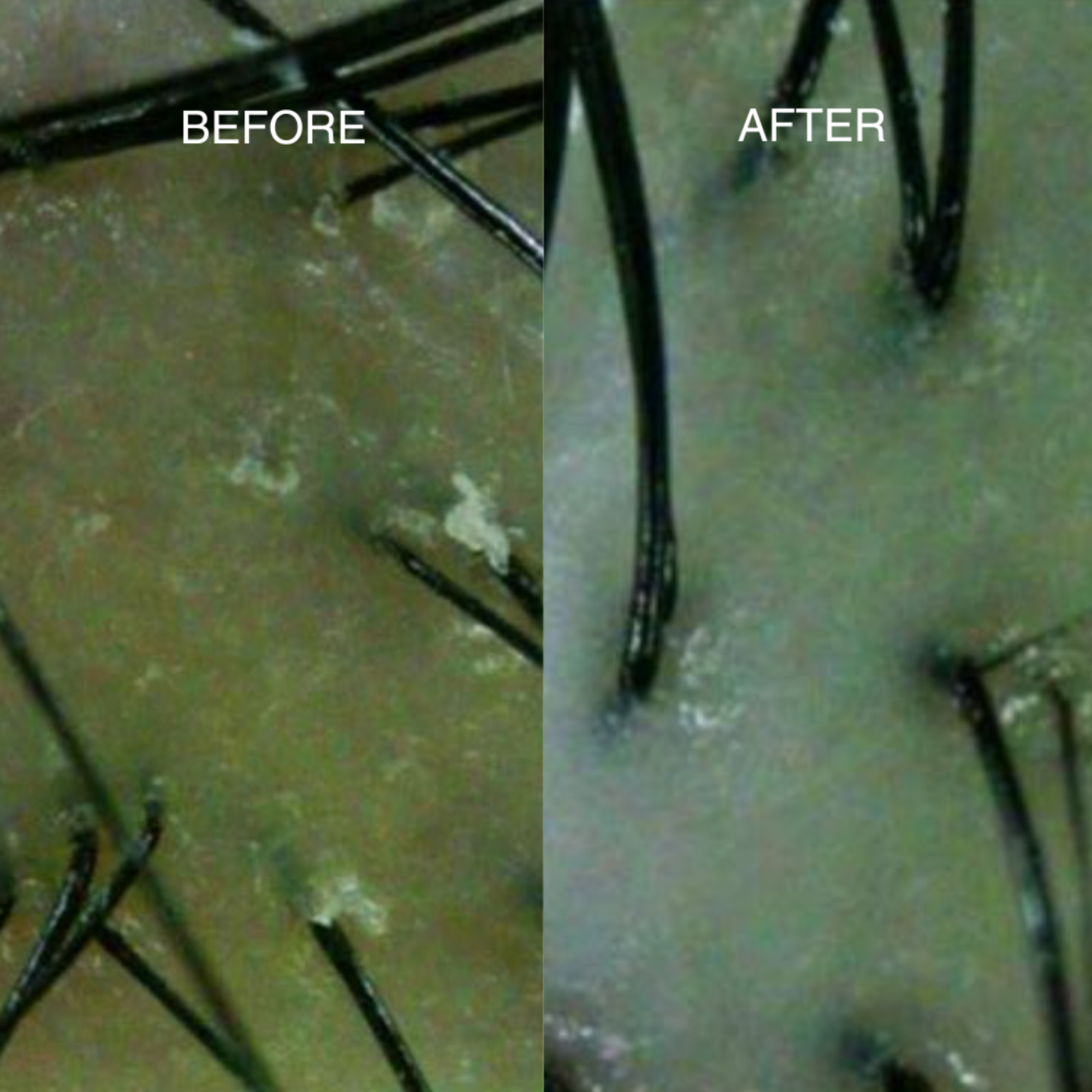 DRGL-DrHair Hair loss Transformation Package-04