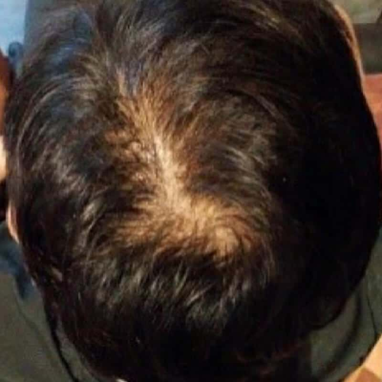 Before